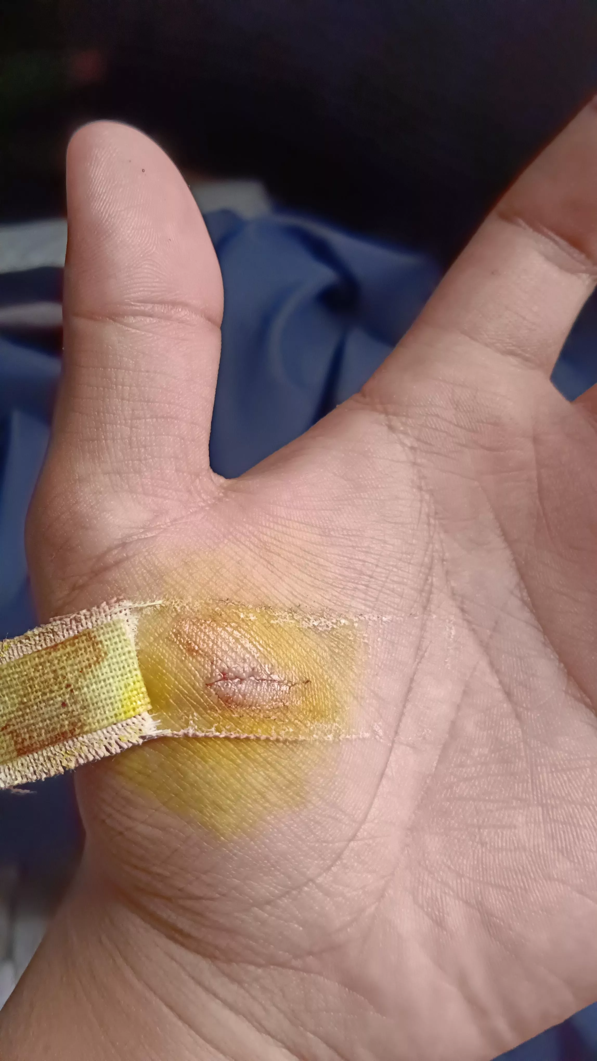 Playing with scissors