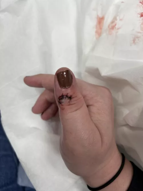 Psa: don’t use a kitchen knife to remove tags