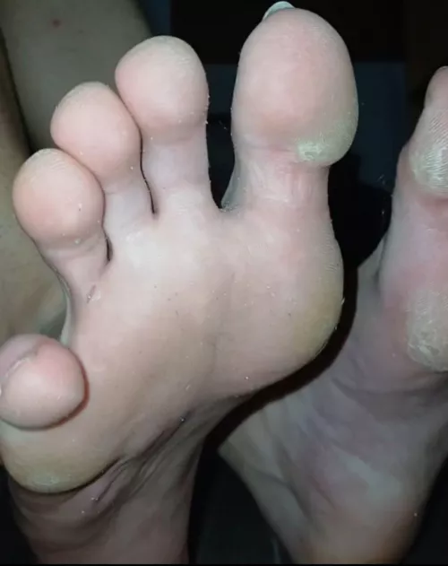 Qui veut lecher mes pieds puants? J'ai 18 ans, ajoutez moi sur snap: julesverser