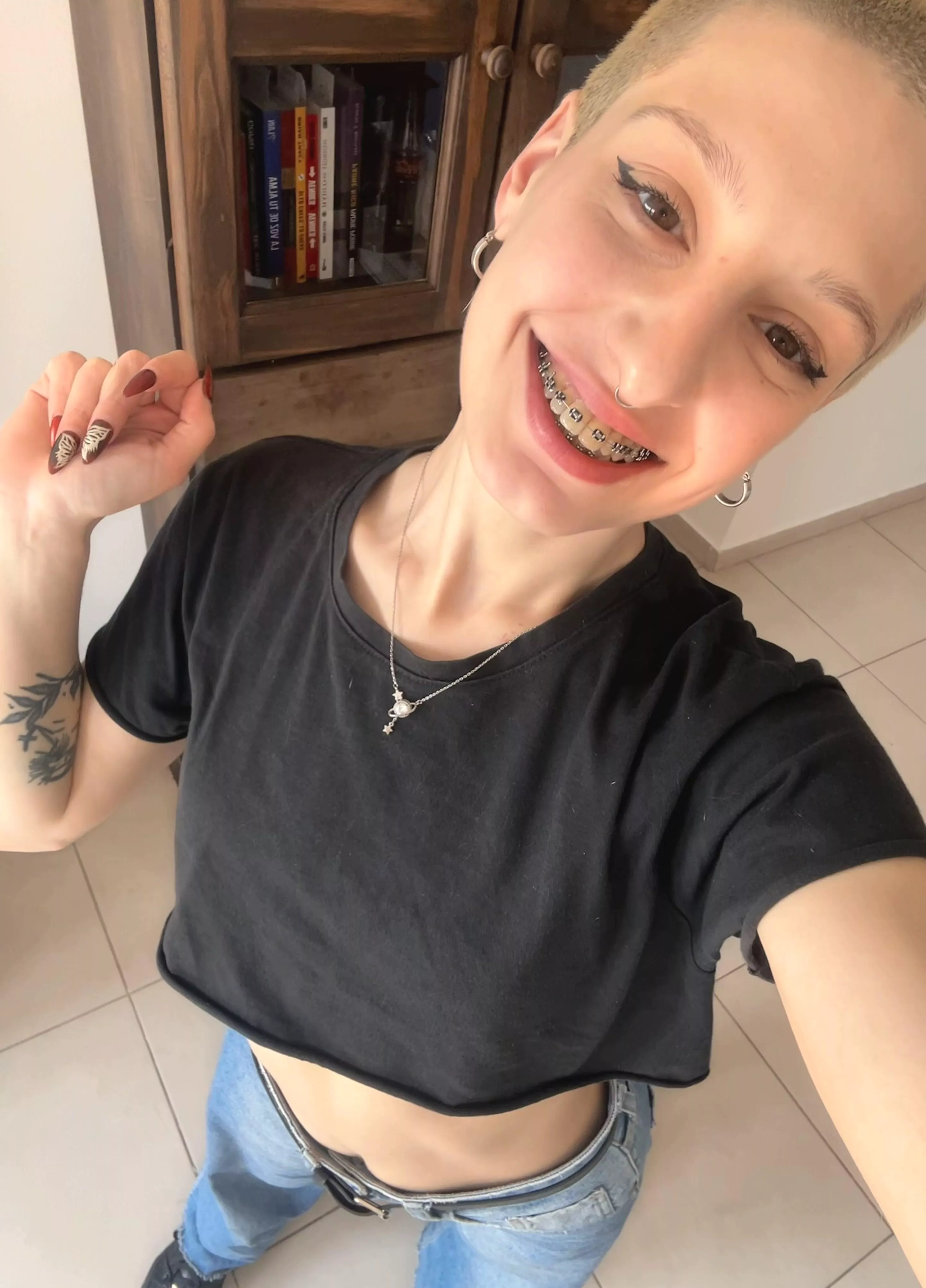 wonder if i should wear these braces forever!