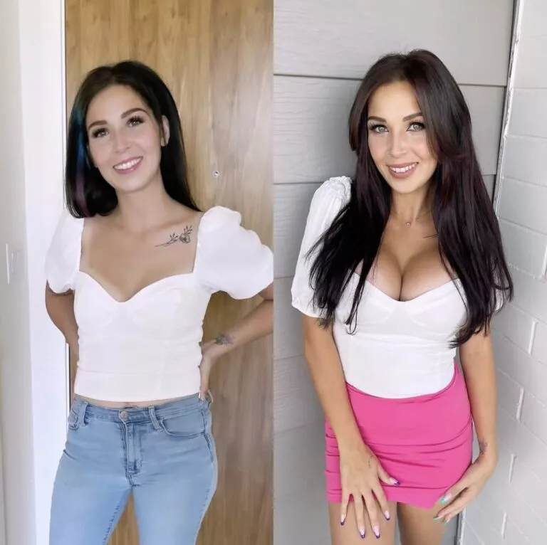 Flat chest to 800cc UHP implants