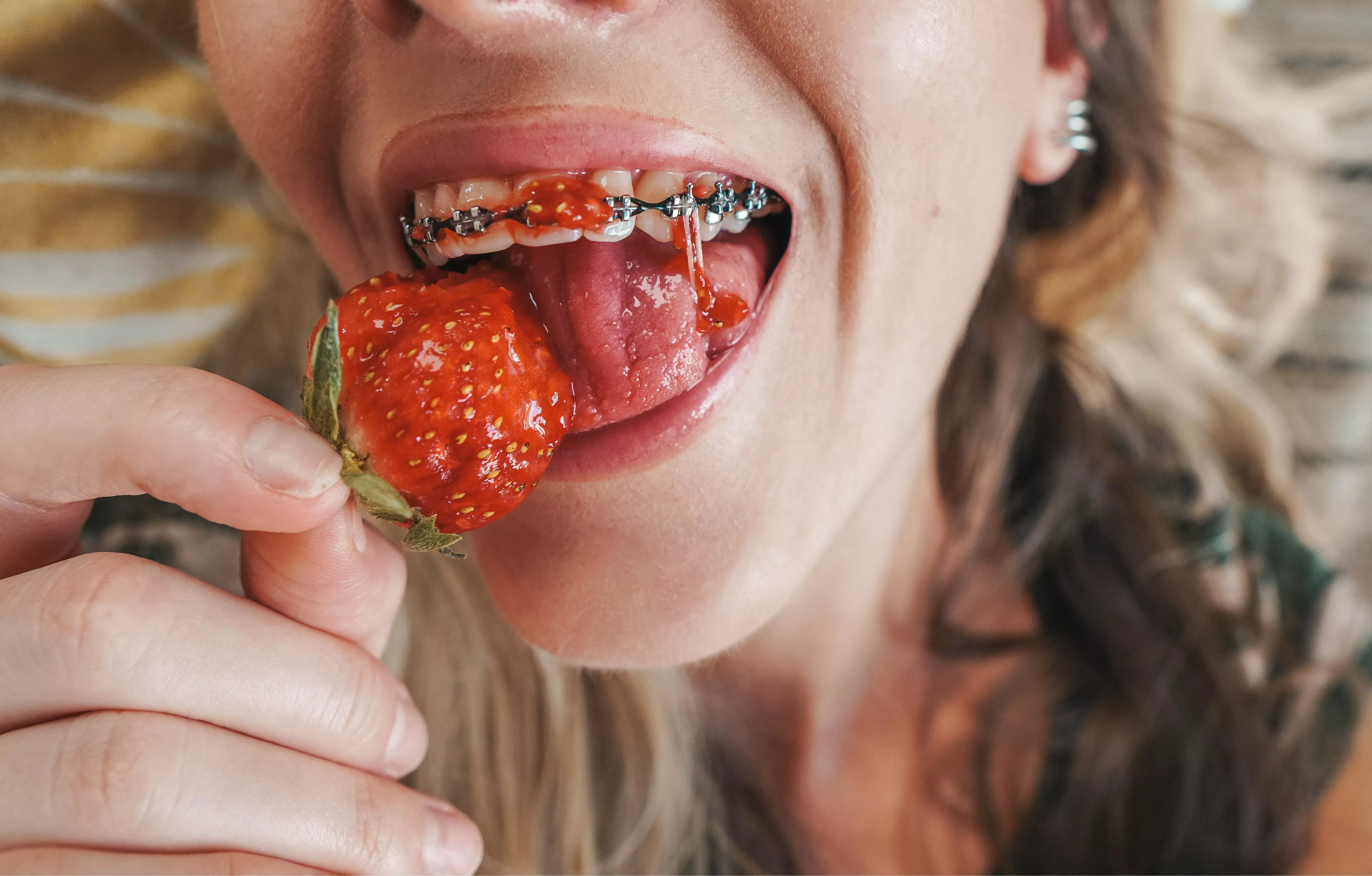 Can you lick my braces clean please?