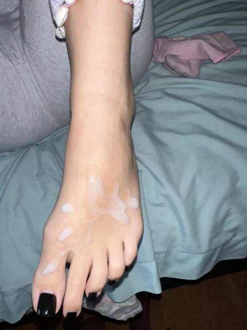Cum on black toenails.. do what you have to do 