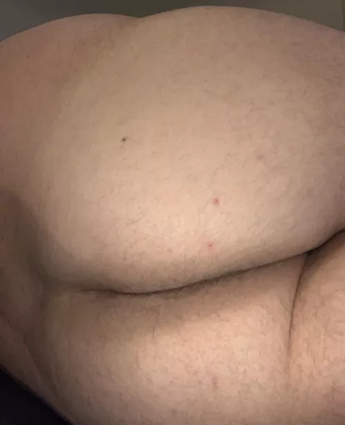 Hvor boller man i det fri i Odense? M29 