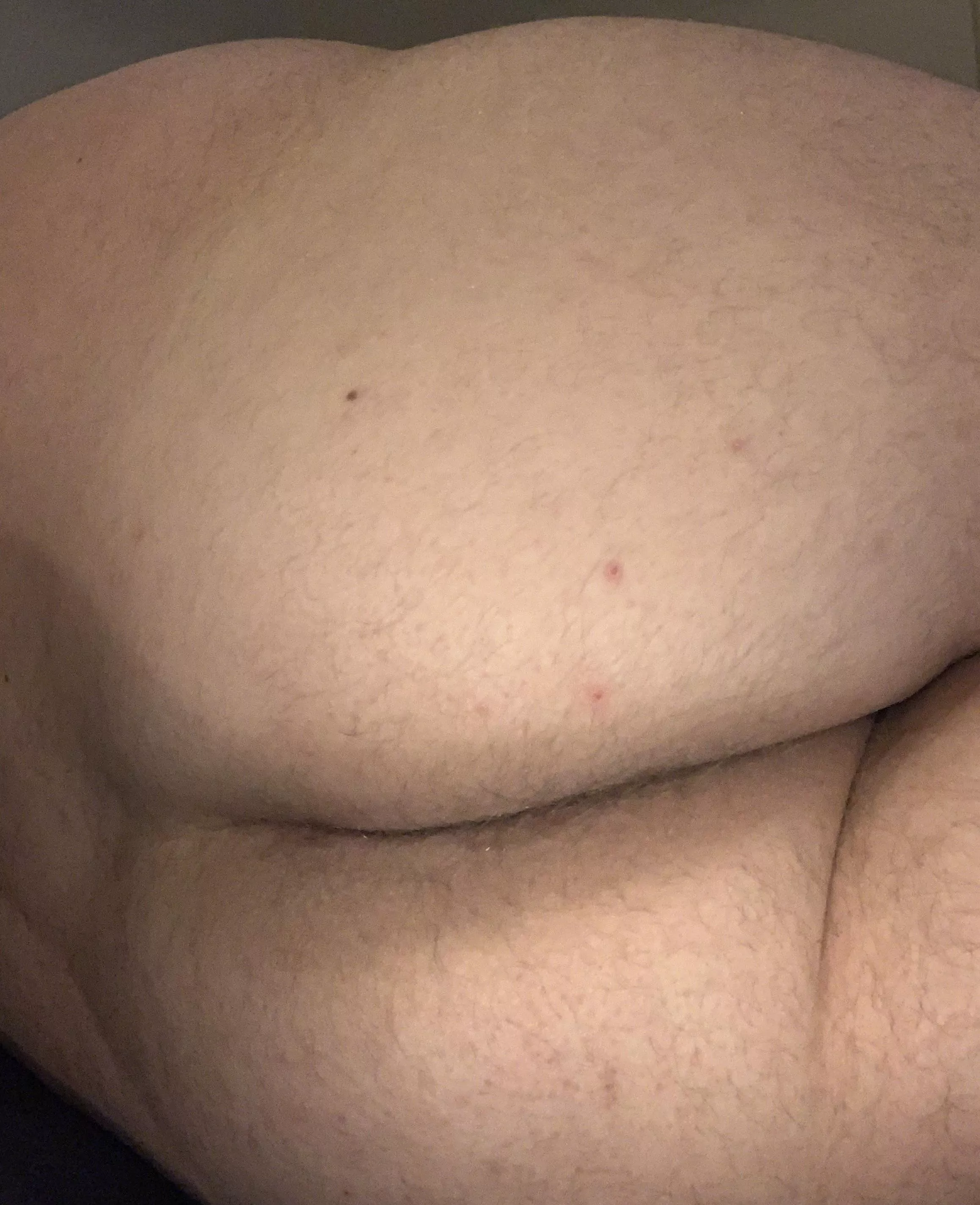 Hvor boller man i det fri i Odense? M29 