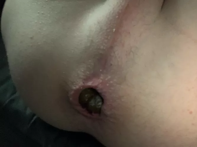 Let’s eat shit together 