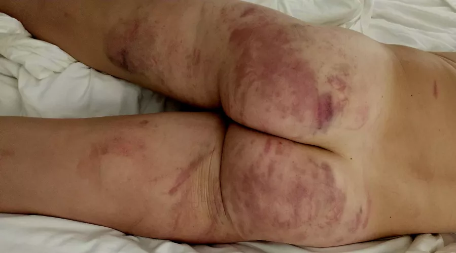 She beat me up good 🥰