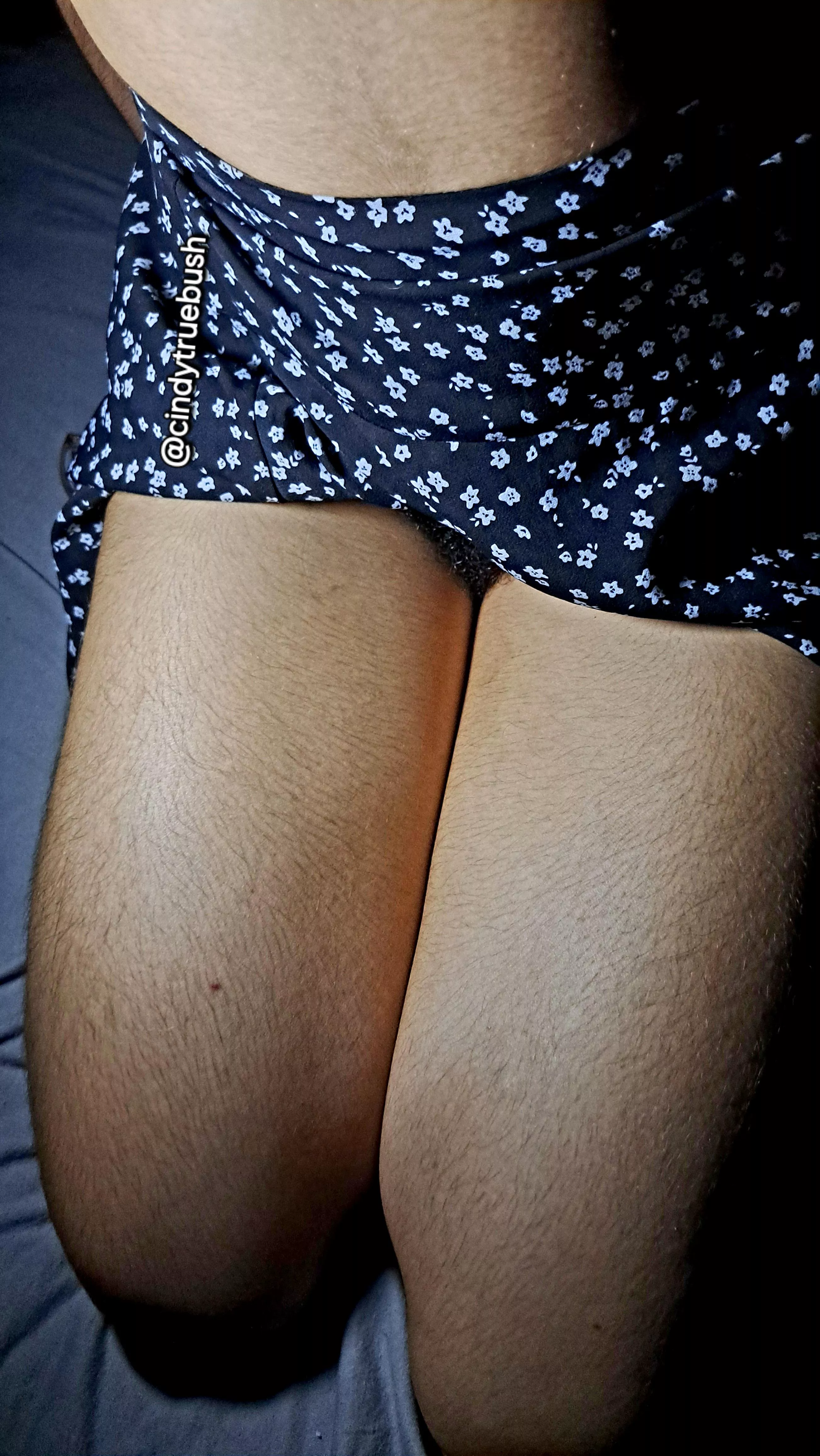 Yummy hairy thighs 💗