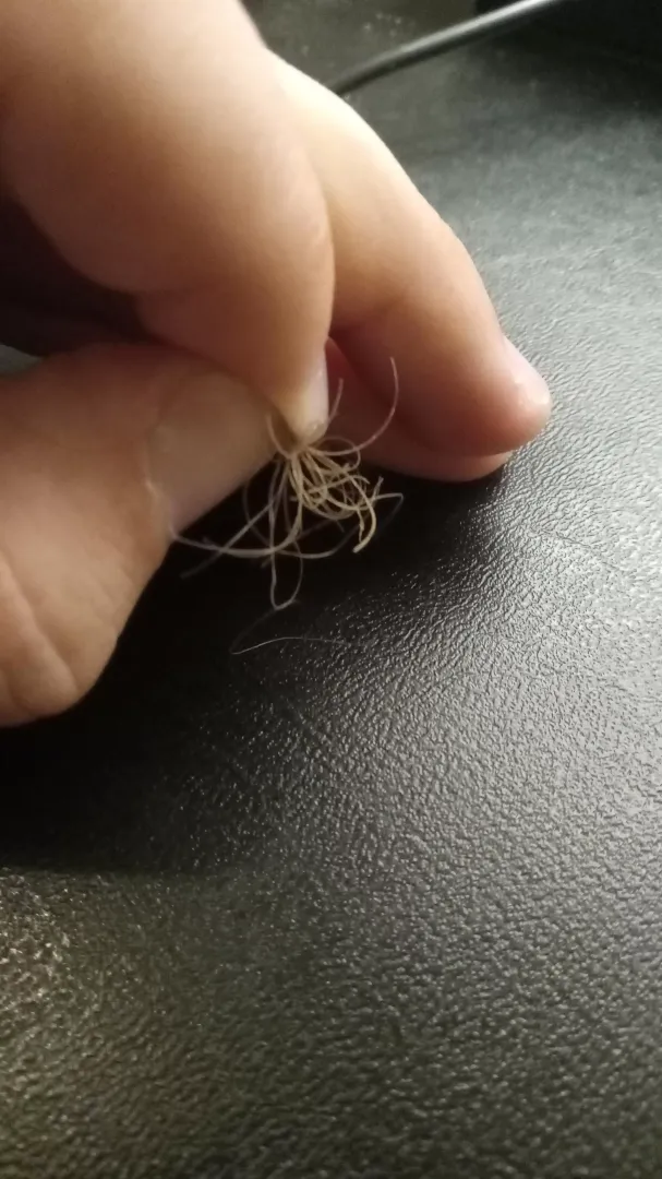 Not sure what this growth is on my public hairs