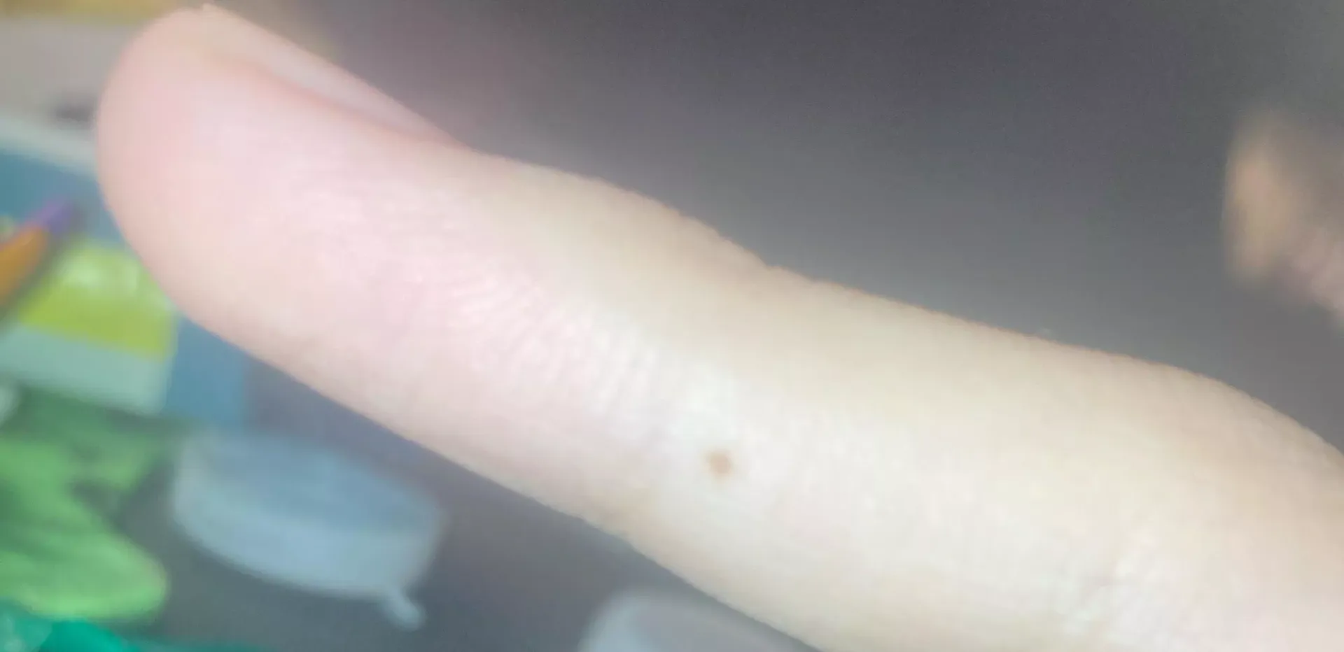 Random brown dot appeared on my finger maybe a week or 2 ago not paint or a scab