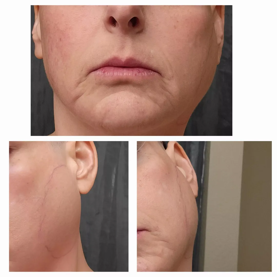 Random swelling on left side of jaw