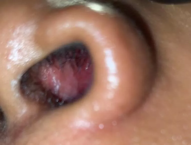 What is this in my nose? Im just