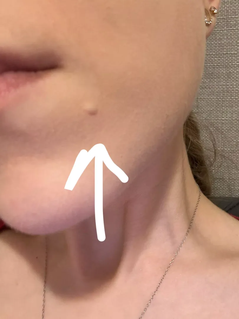 What is this on my face (not pimple)