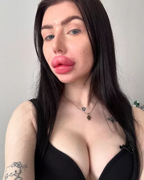 huge lips