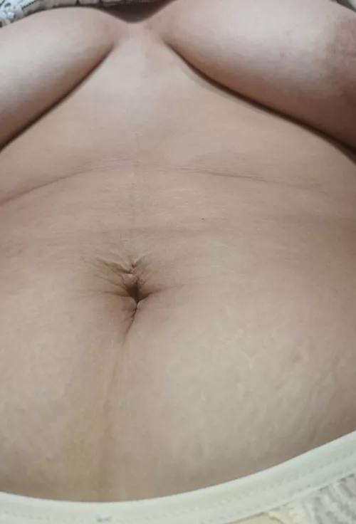 I love my stretch marks! 