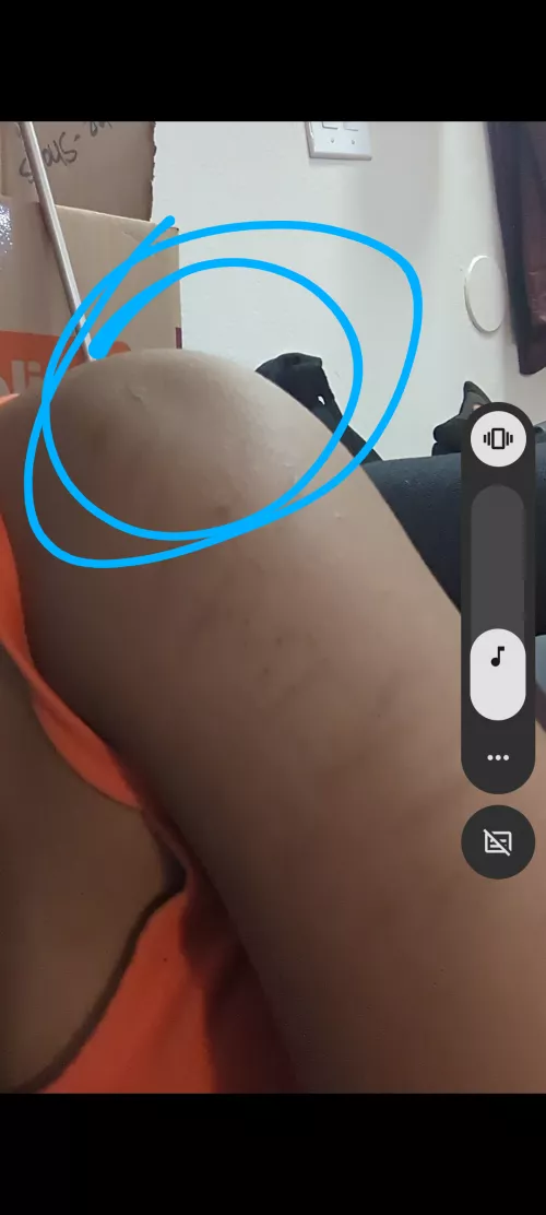 My shoulder looks like it has a dent but it feels like twitching but I don't feel like it is muscle spasms Can someone help me figure this out?