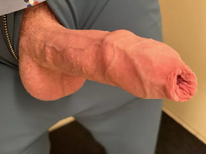 Takes a lot of foreskin to cover up a head this big 