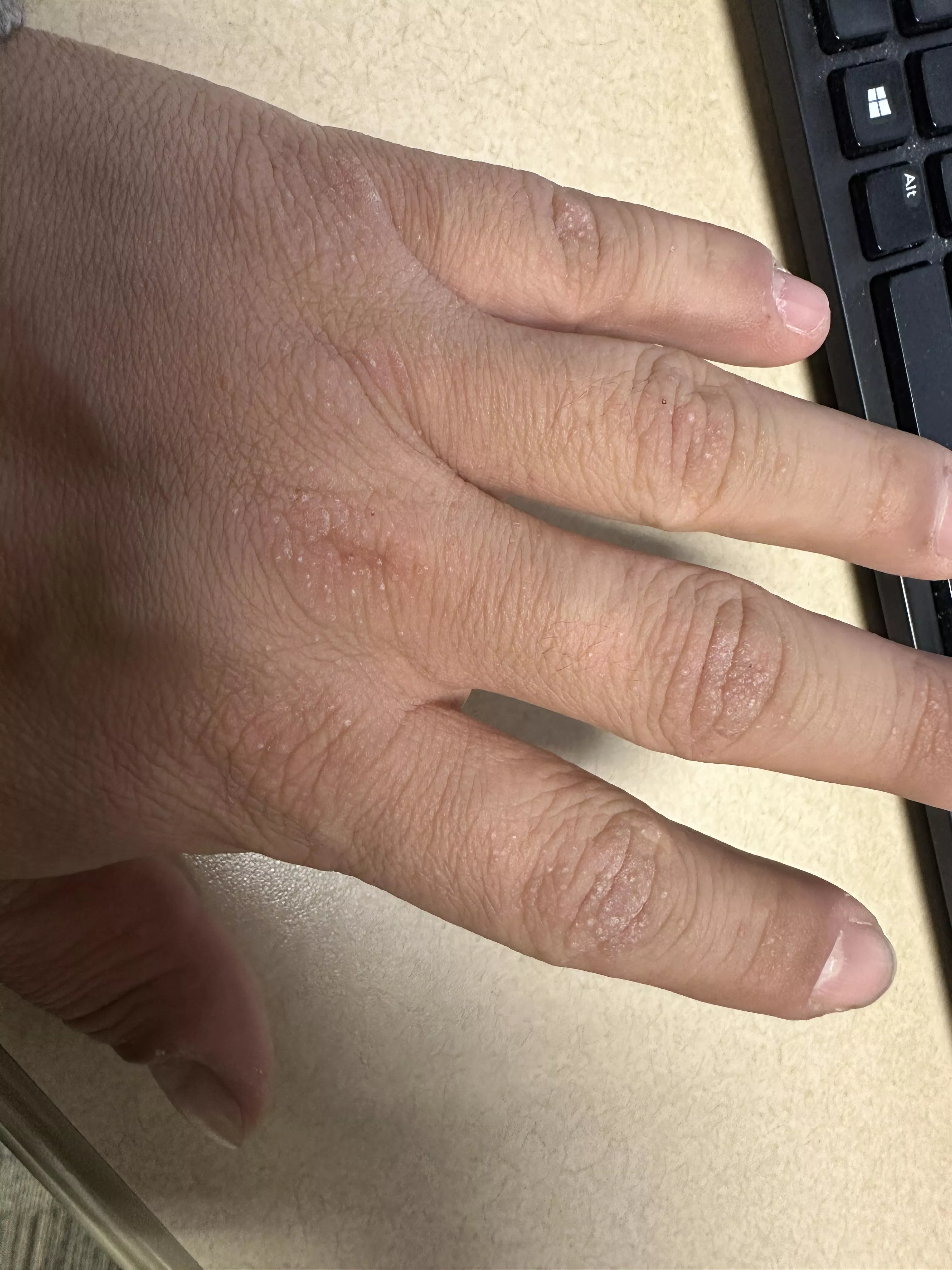 What’s going on with the skin on my hands?