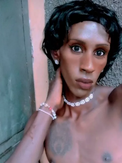 Your skin is not only dark it shines and it tells your story 