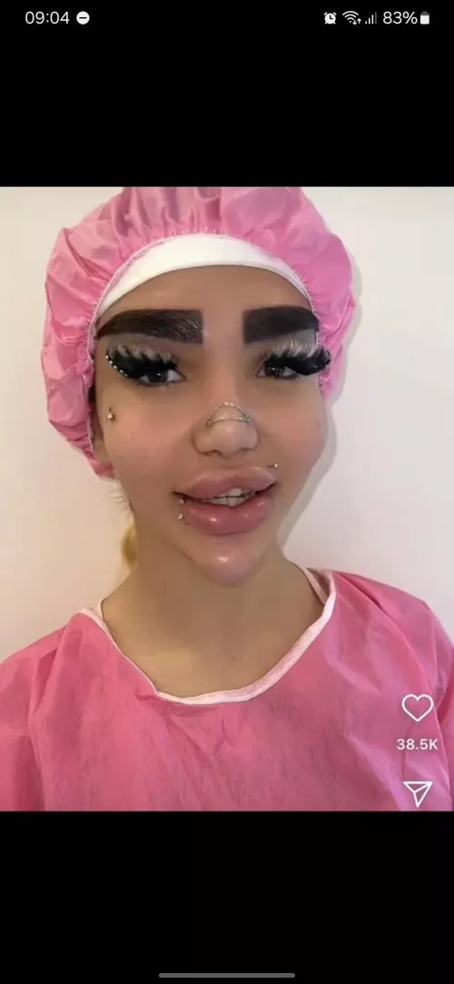 Her lips look like they're about to explode :(