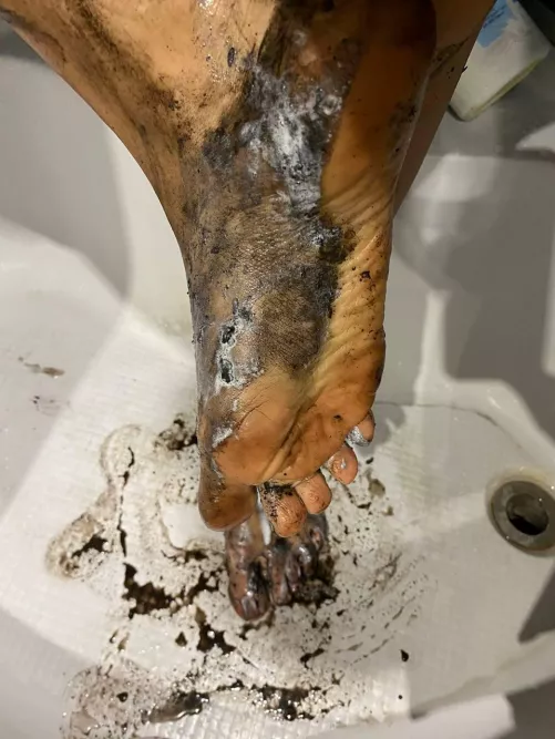 Insanely dirty feet that are very difficult to clean