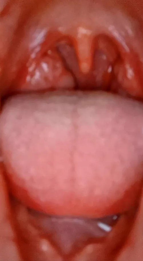 It's too late my tiny one... If you want to survive you'll have to hold on tight to my long uvula.