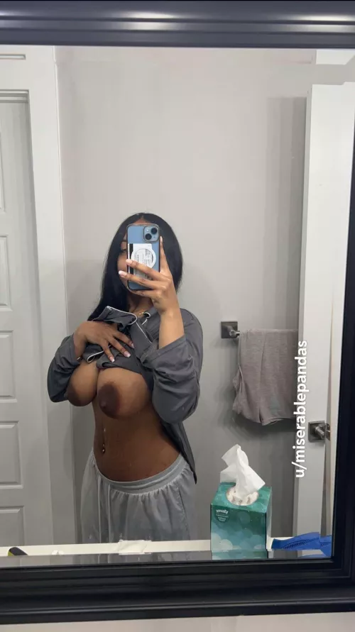 I used to be insecure about them.. now I love them