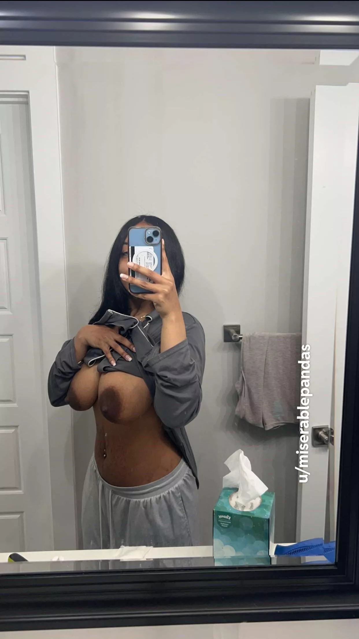 I used to be insecure about them.. now I love them