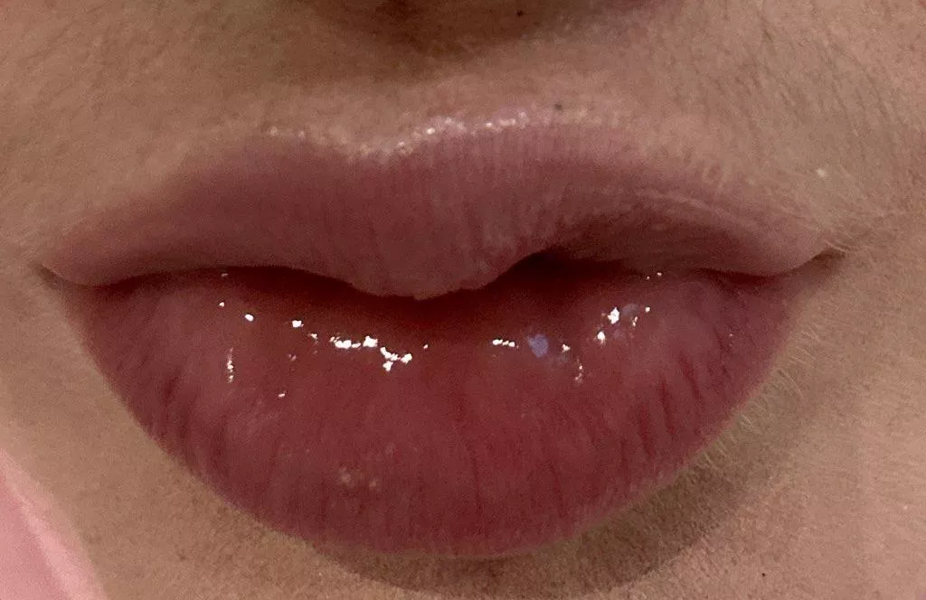 I’m starting to get bimbo lips 