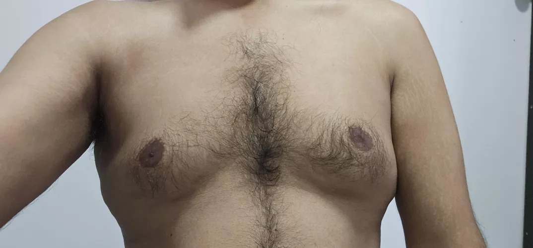 Is this moobs?