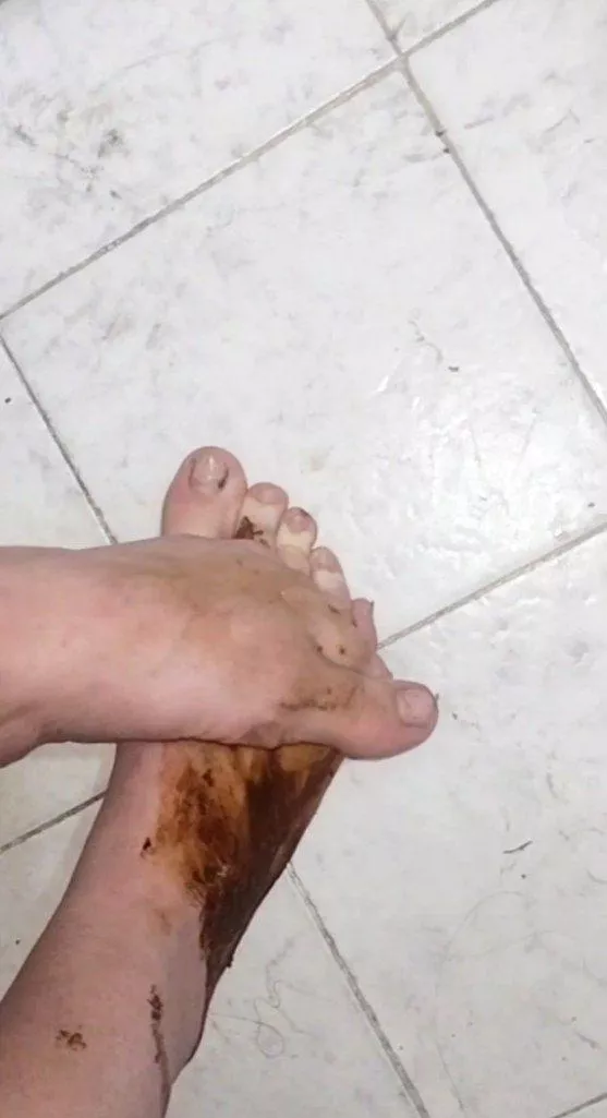 Worship my shitty feet 