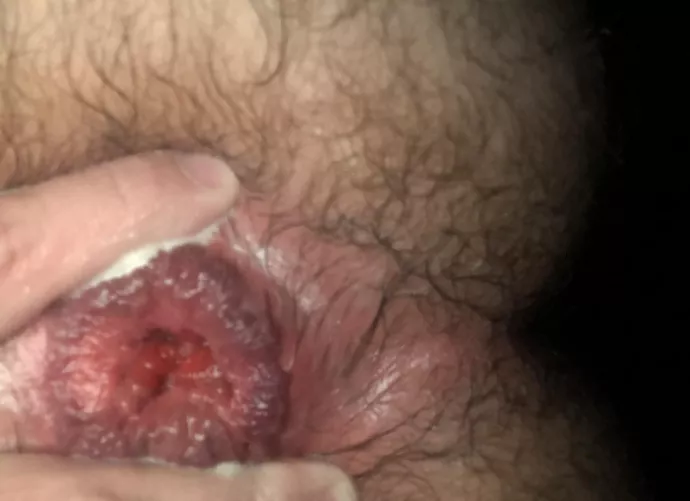 After my first ever fisting session 