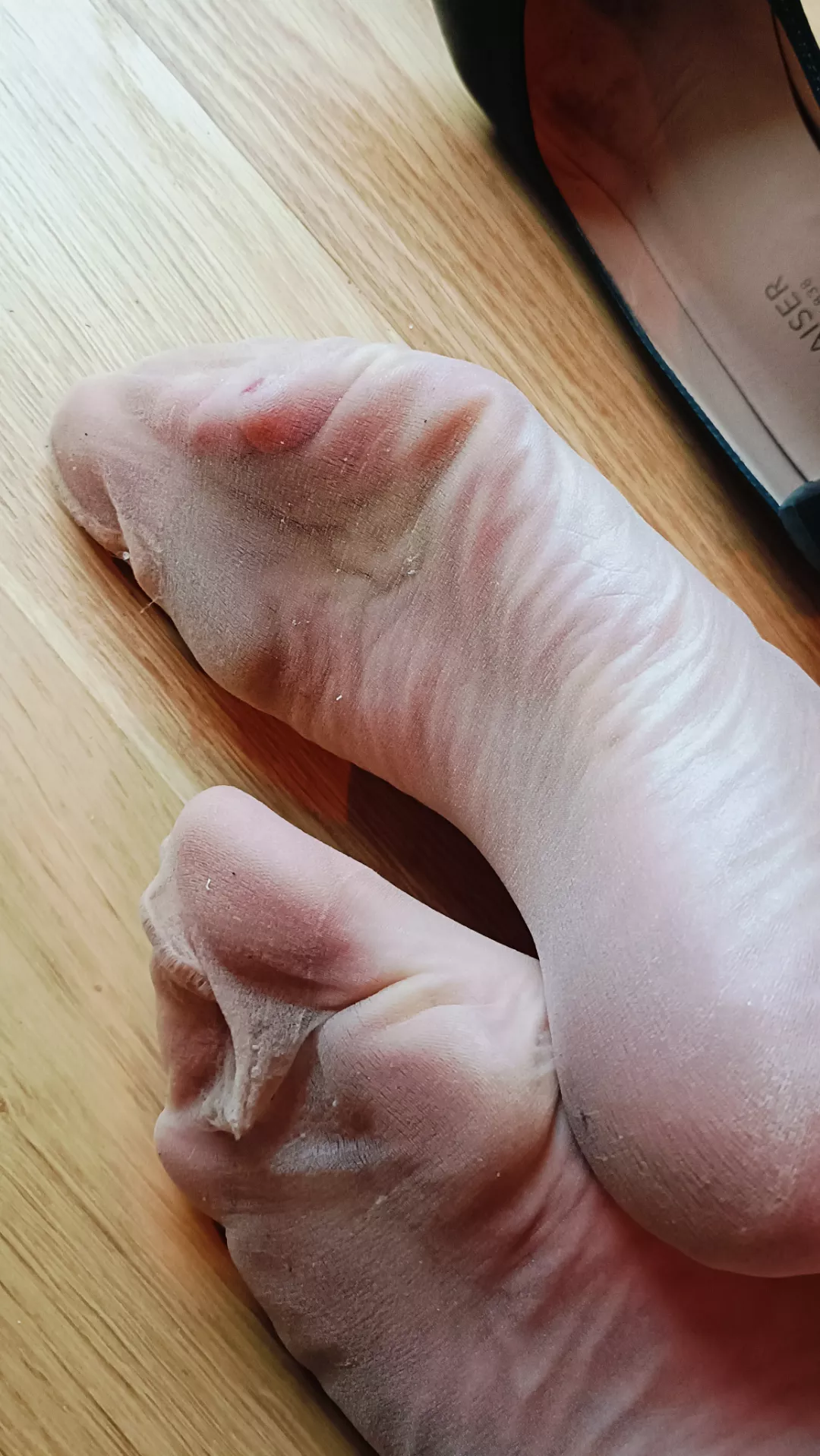 These nylon soles are a filthy, ripped, and wrinkled mess 😱