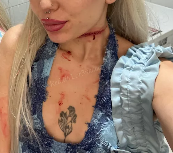 TW : If you look at my profile, you’ll relapse 