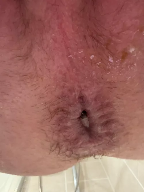 I need to make it looser