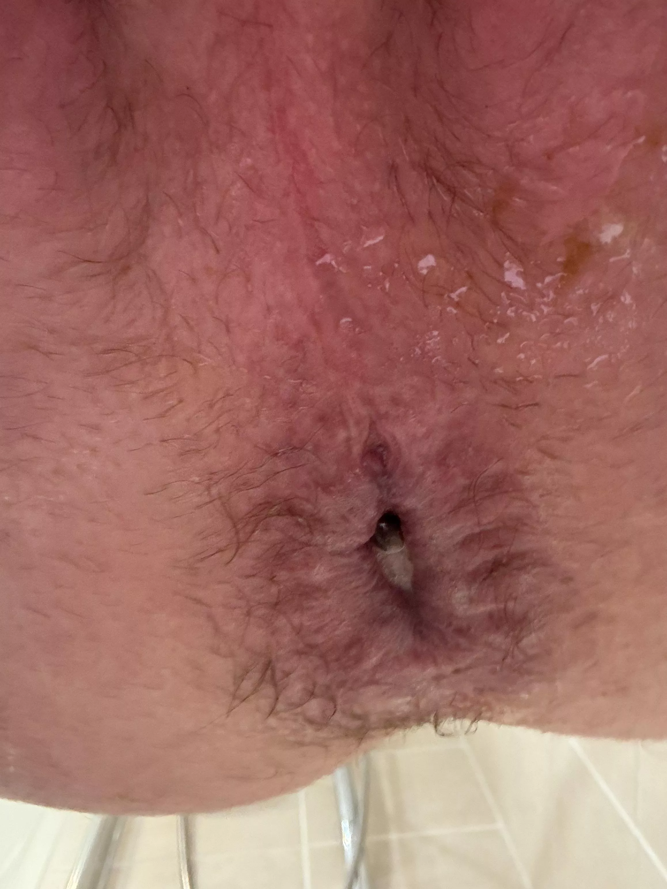 I need to make it looser