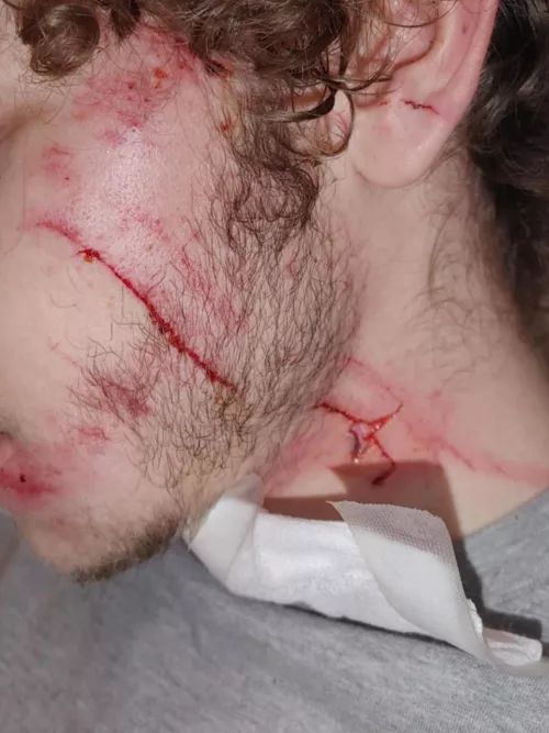 does anyone know how close i came to dying? 