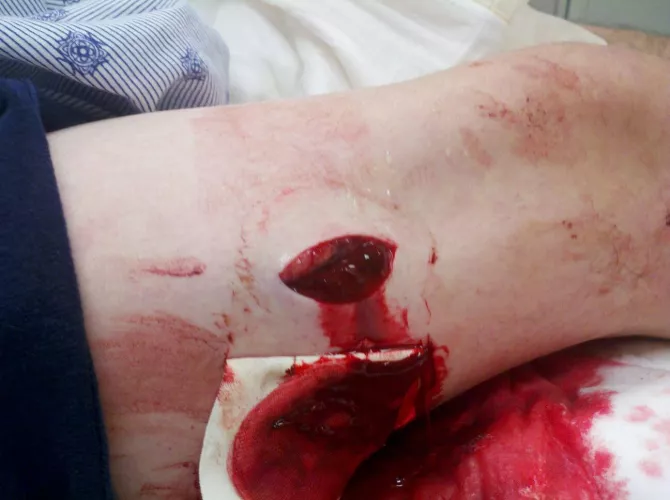 Stabbed no context NSFW 