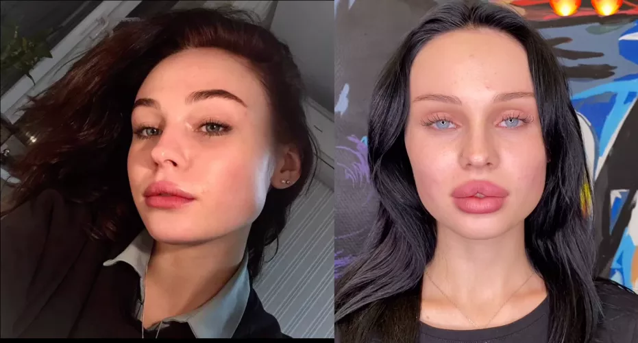Full face before/after