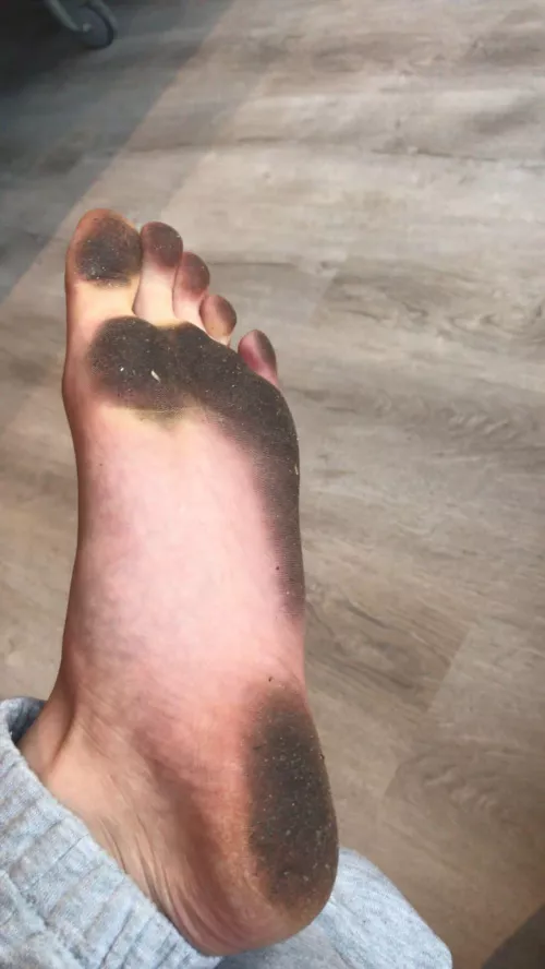 Image where these have been😜