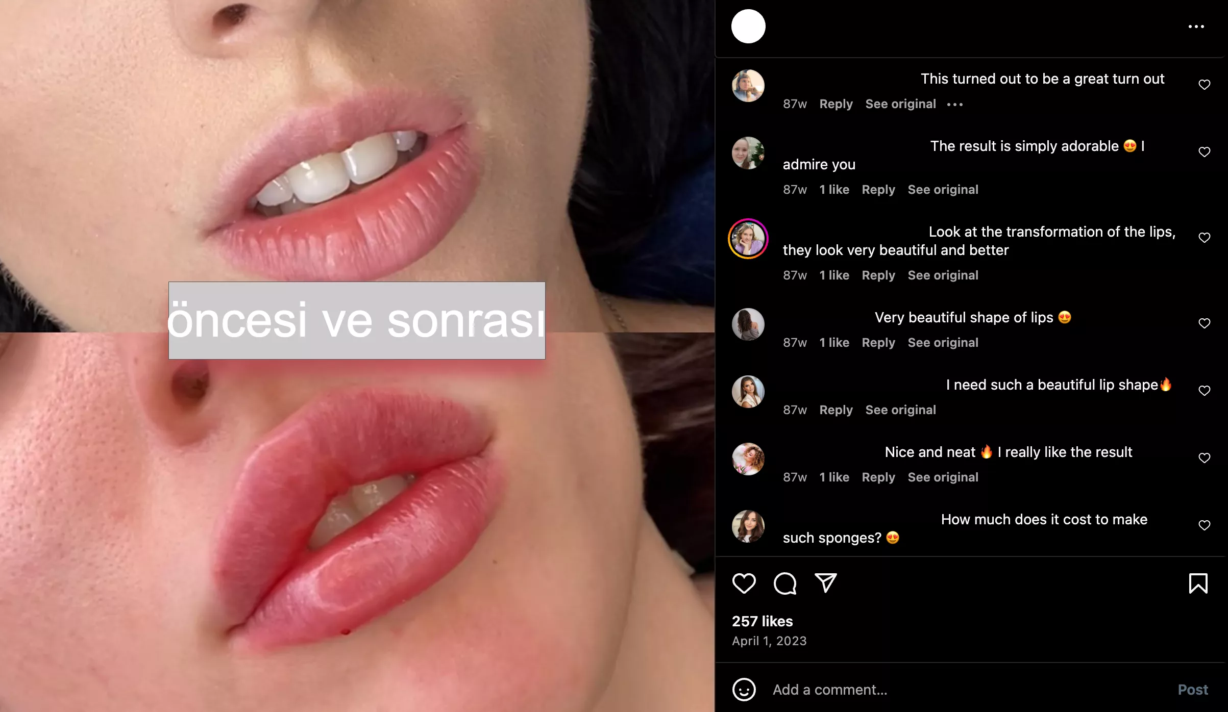 Translated Turkish IG comments