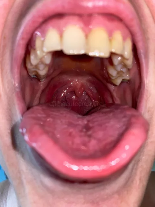 tiny, mommy is hungry! It's time to eat you!