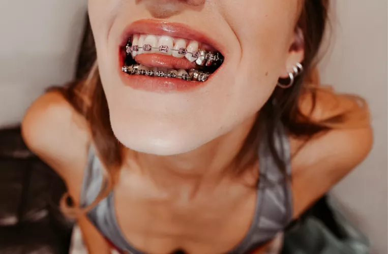 Hi, hope you like my smile