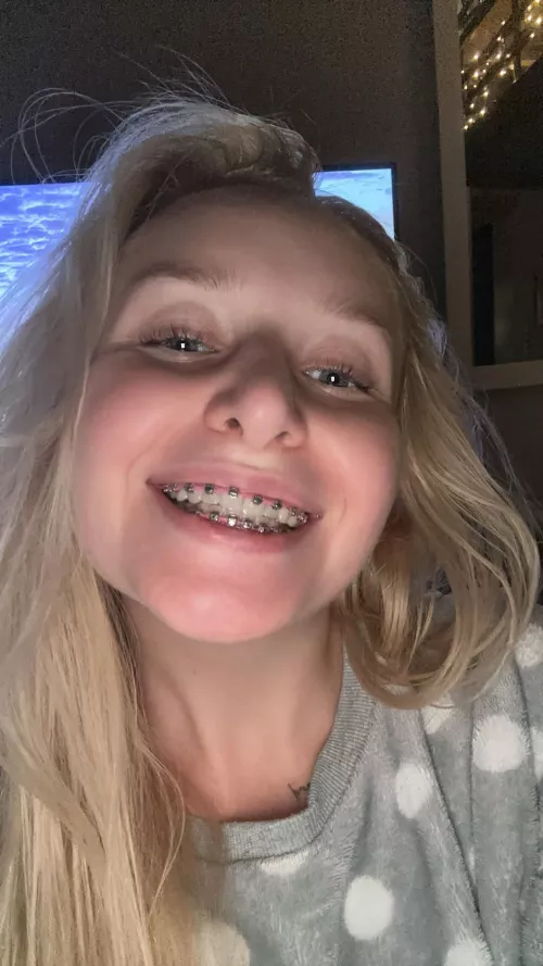 Just put it all over my braces 