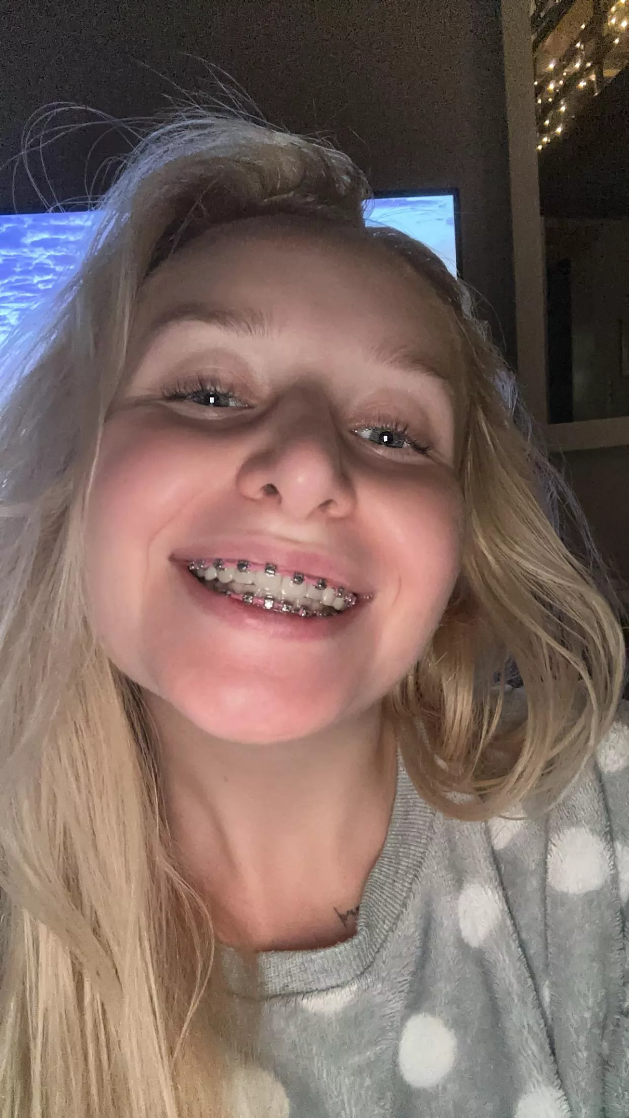 Just put it all over my braces 