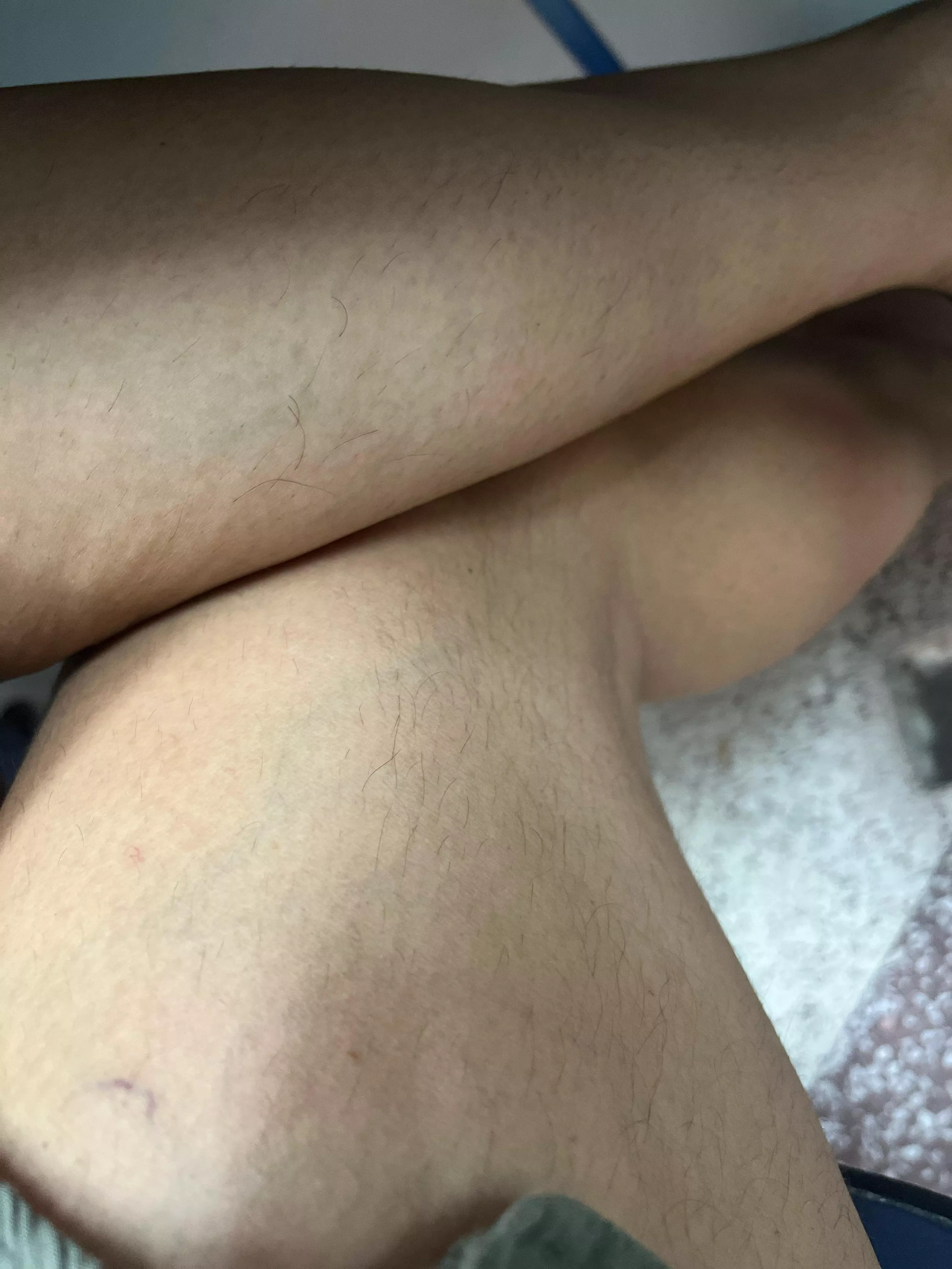 What do you tgink about my hairu legs?