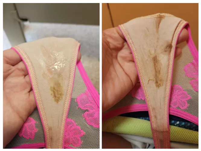 For a moment it was spot cream