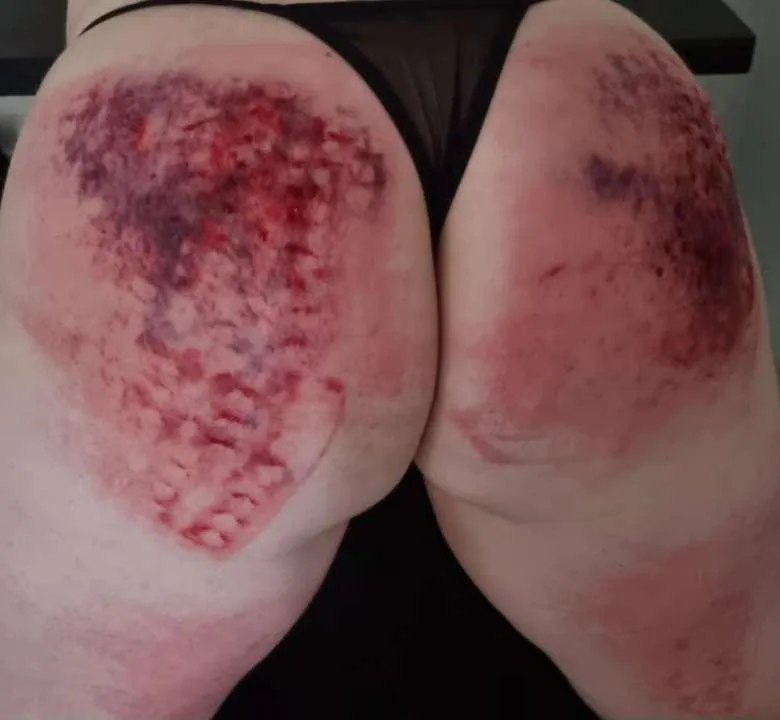 When you can't decide on one toy, so you use them all until she bleeds