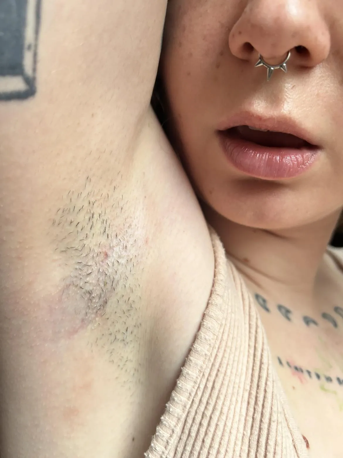 Would you be open to look at my pits?