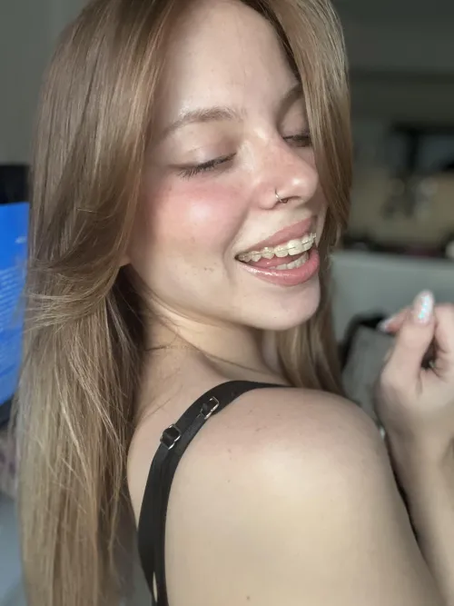 Baby face and braces, cant go wrong with that combo